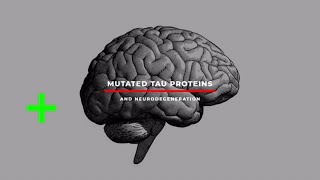 Tau Protein Pathology in Alzheimers Disease [upl. by Adnahs]