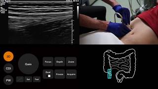 What is Neuroradiology  Dr Glenn Gray [upl. by Weiman187]