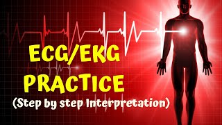 HOW TO READ AN ECG in 10 mins part2   ECG  EKG PRACTICE [upl. by Malca]