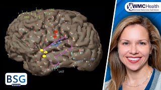 Pharmacology  ANTIEPILEPTIC DRUGS MADE EASY [upl. by Savory54]