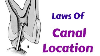 How to Find Canals in RCT  Laws Of Canal Location During ACP  Endodontic Lecture amp Tutorial [upl. by Ziagos683]