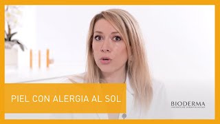 Cómo Saber si Tienes Alergia Solar  BIODERMA [upl. by Ydnih]