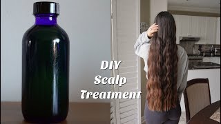 DIY Scalp Treatment for Hair Growth [upl. by Tollman]