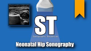 Hip Ultrasound [upl. by Acirtap]