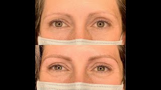 Microblading healing for 40 day by day [upl. by Evangeline]