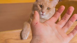 CAT SCRATCH DISEASE  BARTONELLA HENSELAE  Causes Symptoms Treatment Prevention Pathology [upl. by Nilyad51]