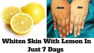 How To Whiten Skin With Lemon In Just 7 Days  Lemon Facial At Home  Lemon For Skin Whitening [upl. by Skardol]