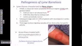 Lyme disease by borrelia [upl. by Vookles]