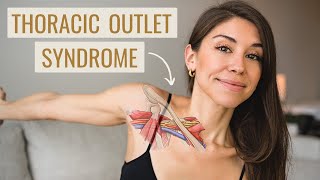 Thoracic Outlet Syndrome Exercises HOW TO FIX IT  Causes Symptoms amp Treatment [upl. by Shwalb]