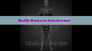 Belly Dancer Syndrome [upl. by Ille]