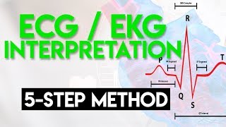 ECG Interpretation Made Easy  ECG EKG Interpretation Part 2 [upl. by Tomkiel]