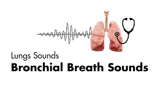 Bronchial Breath Sounds  Lung Sounds  Medzcool [upl. by Stiegler]