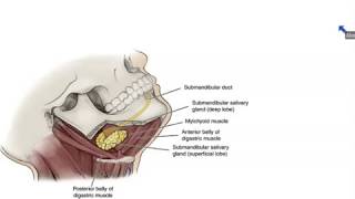 A dog has right sided submandibular mucocoele [upl. by Tiny]