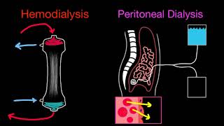 Basics of Dialysis and Modalities [upl. by Rinaldo]