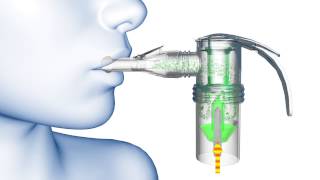 PARI LC® Nebulizer Animation [upl. by Janyte111]