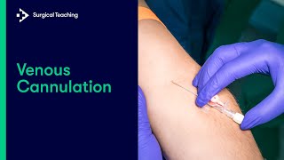 Intravenous IV Cannulation  An Essential Guide [upl. by Nitsug]