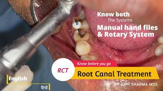 How Root canal treatment  RCT is done  Know both Manual and Rotary system [upl. by Neelrak]