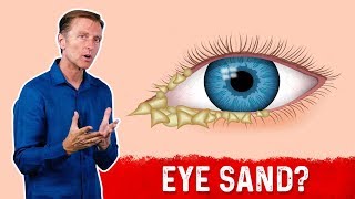 What Causes Crusty Eyes Eye Boogers – DrBerg [upl. by Wendy]