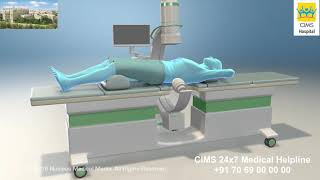 Extracorporeal Shock Wave Lithotripsy ESWL – CIMS Hospital [upl. by Arramat931]