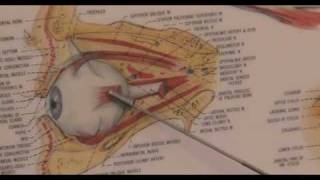 Strabismus Surgery First 3 Months Recovery Expectations [upl. by Ryon613]