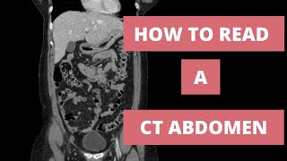 How to read a CT Abdomen for Med students and Residents  Part 1 [upl. by Yenar772]