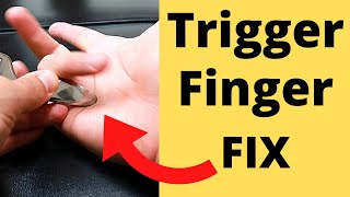 FIX Trigger Finger in 5 Minutes 3 Steps [upl. by Heidie]