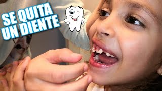 DIENTES DE LECHE como quitarlo sin dolor [upl. by Acinoev]