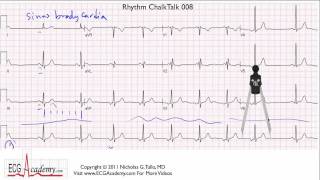 EKG Basics  How to Read amp Interpret EKGs Updated Lecture [upl. by Attelrahs8]