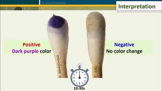 Oxidase Test Five Methods [upl. by Rosalinda]