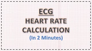 ECG l Eixos e Vetores Cardio 05 [upl. by Oniotna]