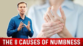 Top 10 causes of Numbness in Hand [upl. by Drofub401]