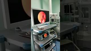 Live Cataract Surgery [upl. by Nari]