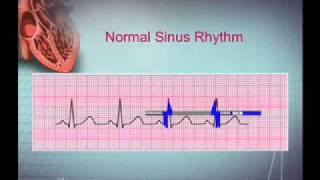 Intro EKG Interpretation Part 1 [upl. by Kristos435]