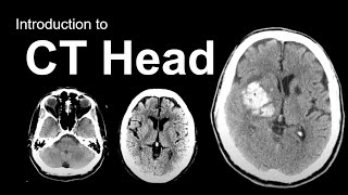 Noncontrast MRI cervical spine search pattern [upl. by Nomled]