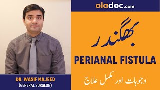 Perianal Fistula Causes Symptoms Treatment Urdu Hindi  Bhagandar Ka Ilaj How To Treat Fistula [upl. by Anastasia]