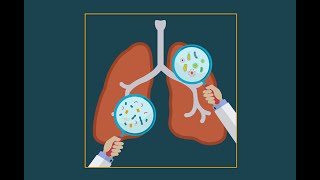 Pneumocystis jiroveci pneumonia pcp [upl. by Hardej678]