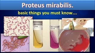 Proteus mirabilissimply clear overviewProteusmirabilisMicrobiologyMLS [upl. by Lonni]