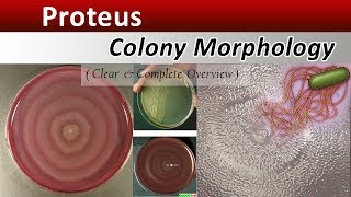 Proteus Colony Morphology  Clear Explain [upl. by Mavra]