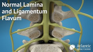 Ligaments of the Hand [upl. by Grange]