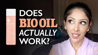 BIO OIL Review by DOCTOR V Brown Dark skin  stretch marks pigmentation how to use DR V SOC [upl. by Ashling]