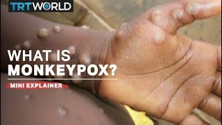 What is monkeypox [upl. by Bolt]