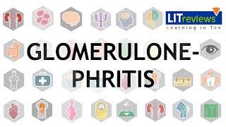 Glomerulonephritis [upl. by Richart]