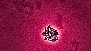 Lactobacillus  Time Lapse Photography [upl. by Nylrebma66]