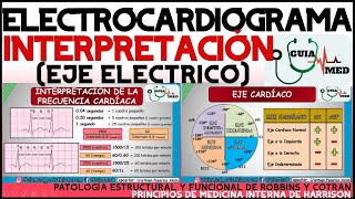 ELECTROCARDIOGRAMA INTERPRETACIÓN  GuiaMed [upl. by Stanhope]