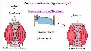 How to Perform Orthostatic Hypotension Testing [upl. by Rombert]