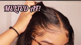 How to RE Install Frontal Wigs for Beginners  VERY DETAILED  Melt Transparent Lace [upl. by Nospmas833]