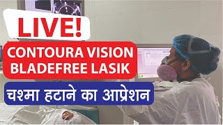 Contoura Vision Laser Eye Surgery for Astigmatism  Topographyguided LASIK PRK [upl. by Danni]