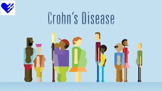 Crohns Disease and Its Effect on the Body [upl. by Cleavland]