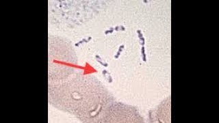 Safety pin appearance or bipolar staining [upl. by Nolyaw72]