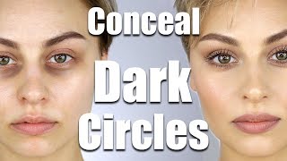 How To Conceal Dark Circles Under Eyes  Alexandra Anele [upl. by Marilin14]